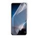 Плівка гідрогелева для Huawei Mate 10 Lite глянсова на хуавей мейт 10 лайт прозора 0009362 фото 1